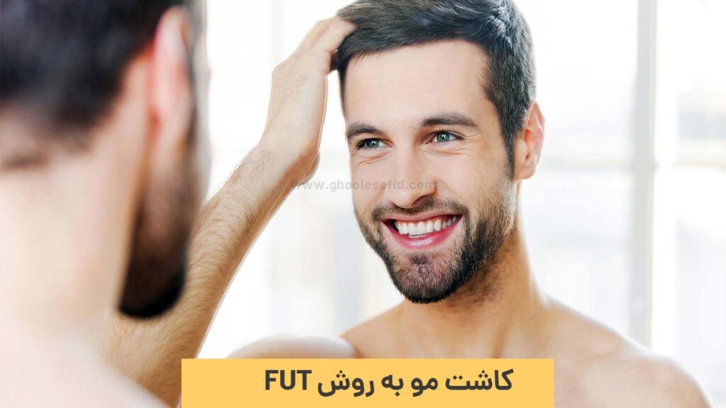 کاشت مو به روش FUT
