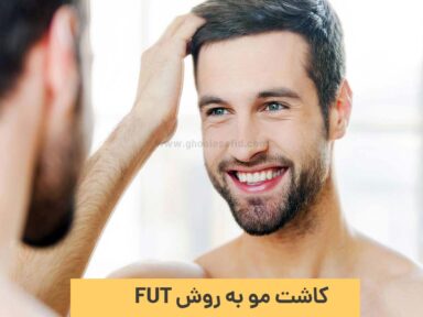 کاشت مو به روش FUT