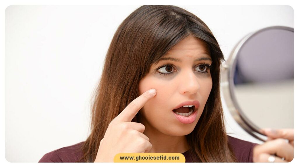 عکس کاندید فیلر زیر چشم