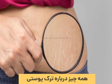 ترک پوستی چیست؟ دلیل، نشانه ها و روش های درمان آن