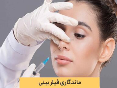 ماندگاری فیلر بینی چقدر است؟