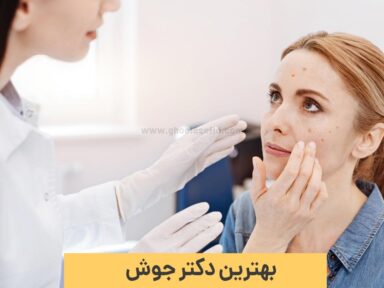 بهترین دکتر جوش چه کسی است؟