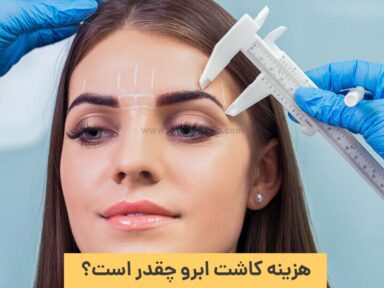 هزینه کاشت ابرو در سال 1402 چقدر است؟