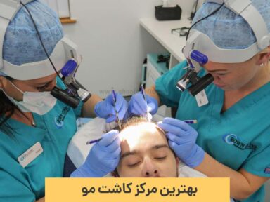 بهترین مرکز کاشت مو در تهران کجاست؟