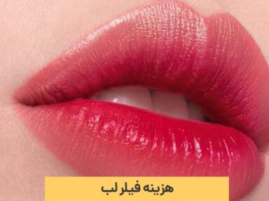 هزینه فیلر لب چقدر است؟