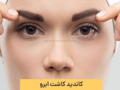 کاندید کاشت ابرو چه کسانی هستند؟