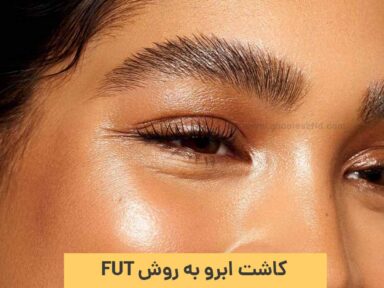 کاشت ابرو به روش FUT؛ مزایا + معایب + مراحل + هزینه